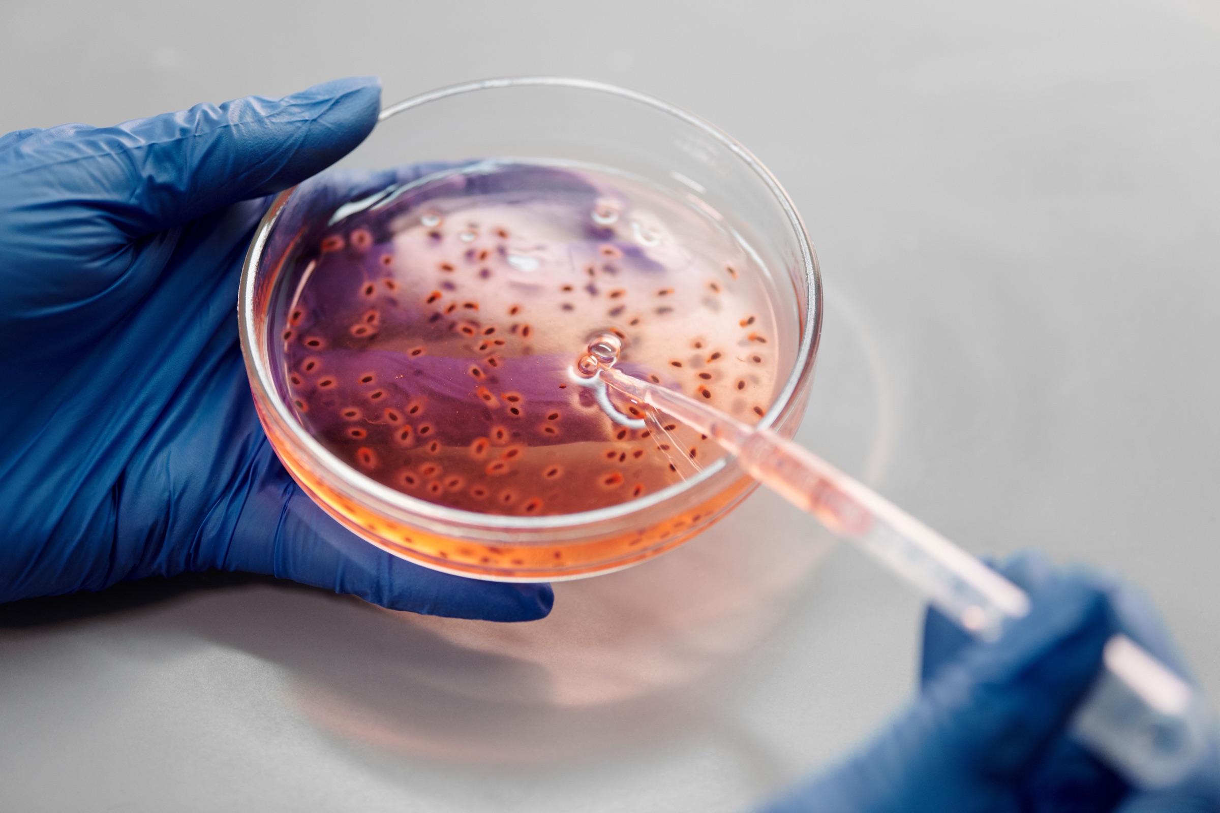 Laboratory petri dish and pipette used for microbiology research